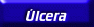 Ulcera Duodenal